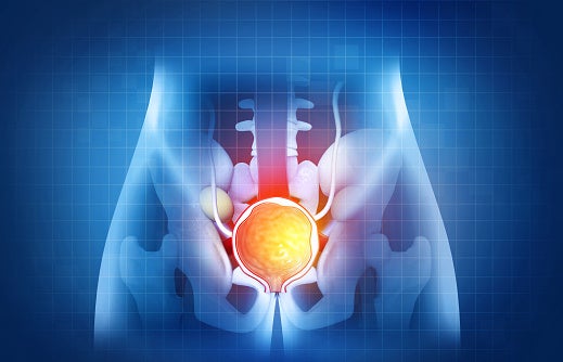 Rendering of a prostate inside the body